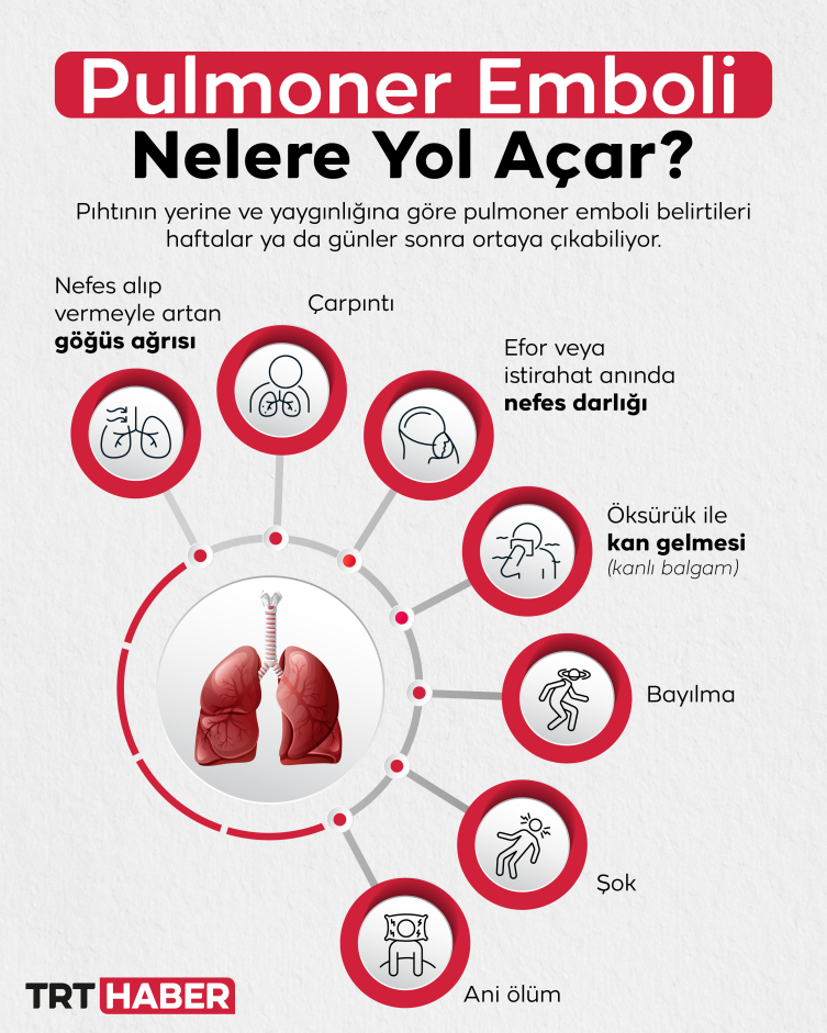 Grafik: TRT Haber